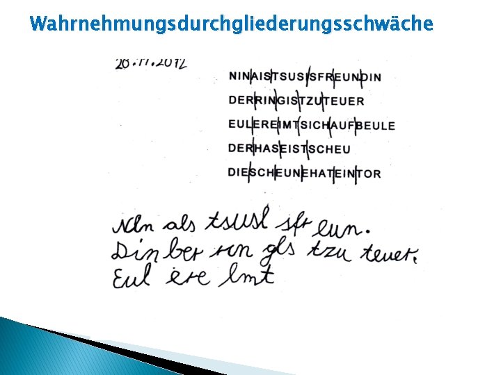 Wahrnehmungsdurchgliederungsschwäche 