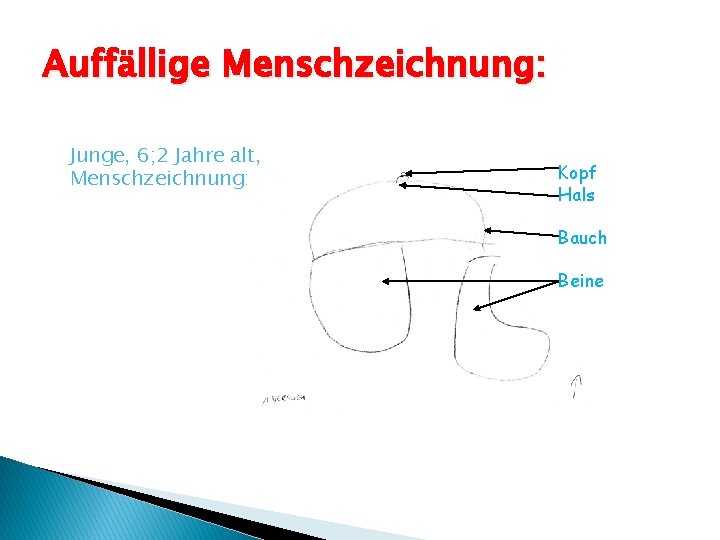 Auffällige Menschzeichnung: Junge, 6; 2 Jahre alt, Menschzeichnung: Versuch: Kopf Hals Bauch Beine 