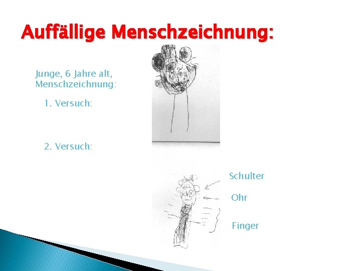 Auffällige Menschzeichnung: Junge, 6 Jahre alt, Menschzeichnung: 1. Versuch: 2. Versuch: Schulter Ohr Finger