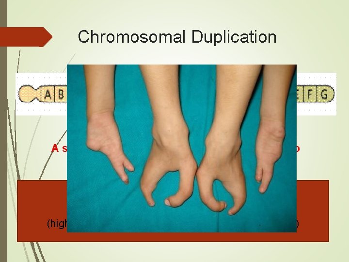 Chromosomal Duplication A segment of genes is copied twice and added to the chromosome