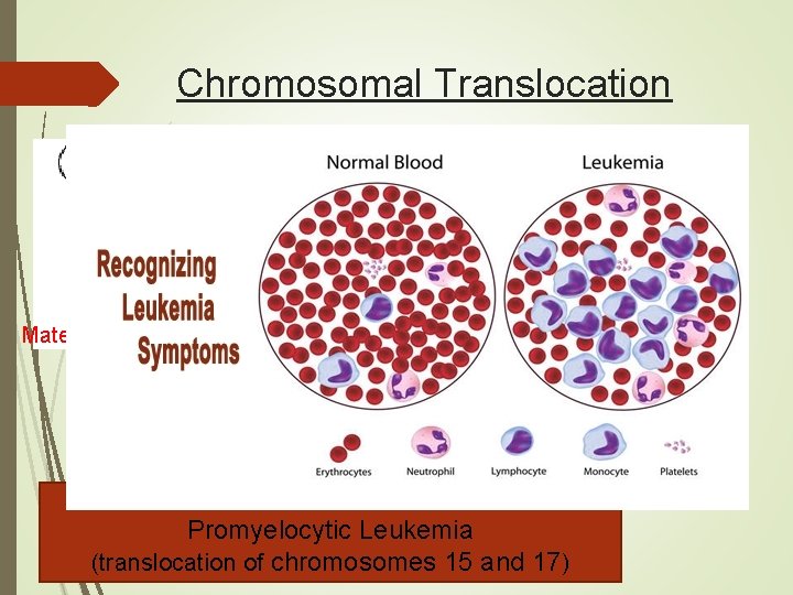 Chromosomal Translocation Material is swapped with another chromosome Causes: Promyelocytic Leukemia (translocation of chromosomes