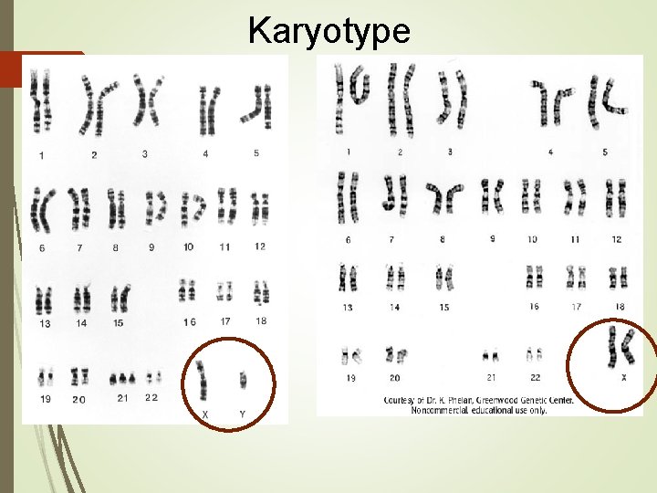 Karyotype 