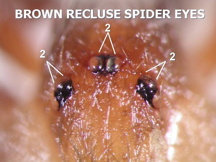 BROWN RECLUSE SPIDER EYES 2 2 2 