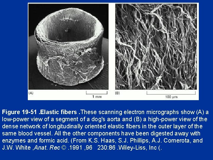 Figure 19 -51. Elastic fibers. These scanning electron micrographs show (A) a low-power view