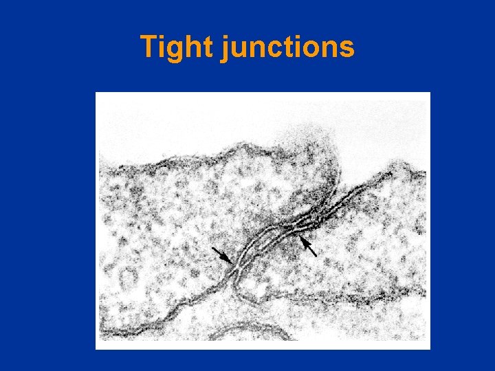 Tight junctions 