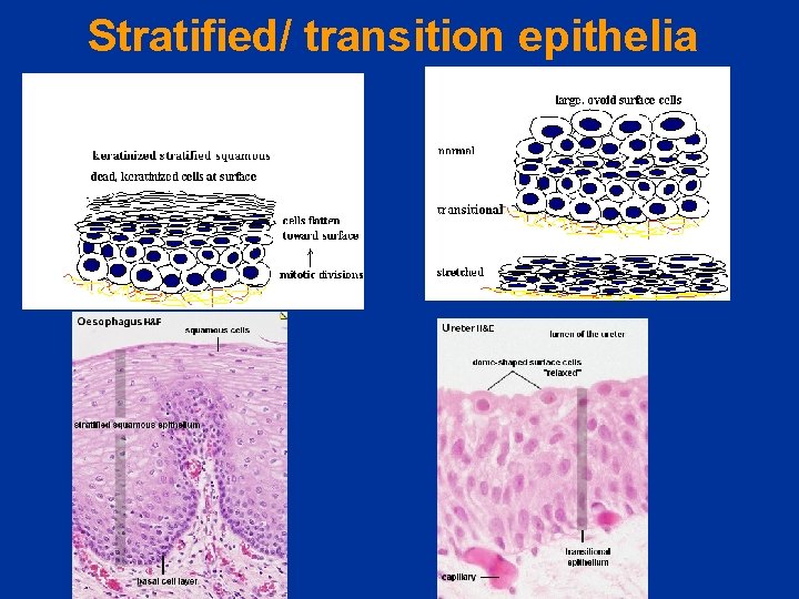 Stratified/ transition epithelia 