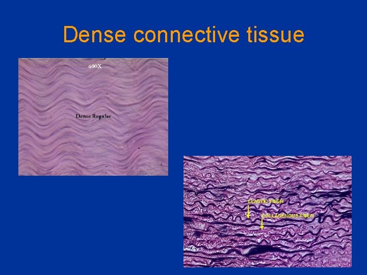 Dense connective tissue 