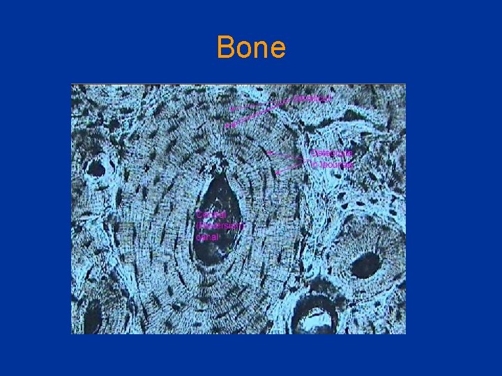 Bone 