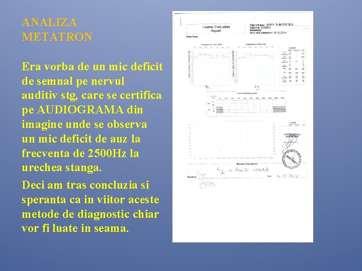 ANALIZA METATRON Era vorba de un mic deficit de semnal pe nervul auditiv stg, ANALIZA METATRON Era vorba de un mic deficit de semnal pe nervul auditiv stg,