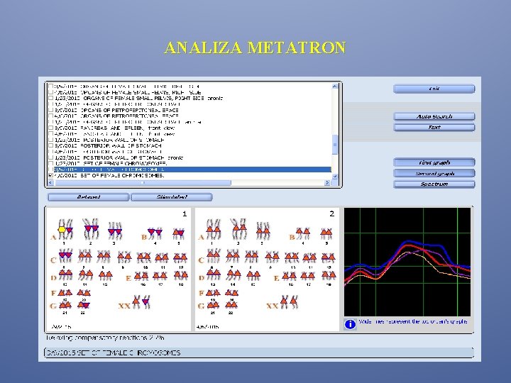 ANALIZA METATRON ANALIZA METATRON