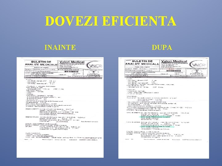 DOVEZI EFICIENTA INAINTE DUPA DOVEZI EFICIENTA INAINTE DUPA