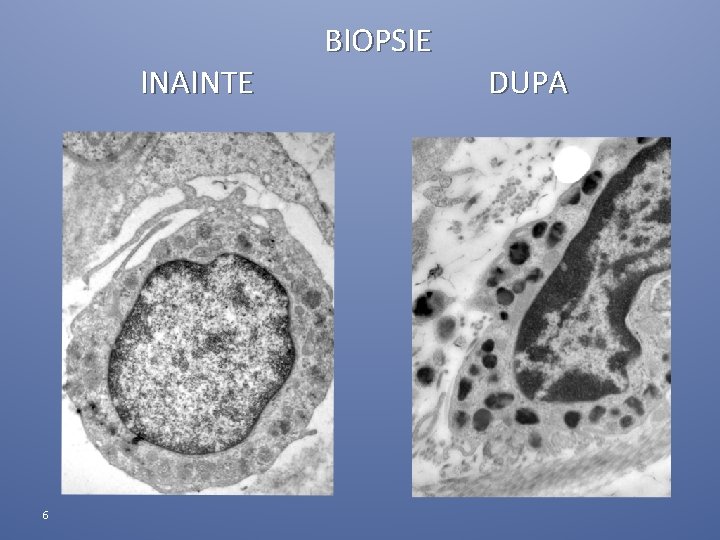 INAINTE 6 BIOPSIE DUPA INAINTE 6 BIOPSIE DUPA