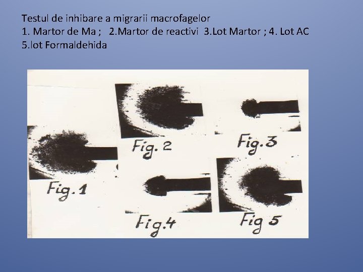 Testul de inhibare a migrarii macrofagelor 1. Martor de Ma ; 2. Martor de Testul de inhibare a migrarii macrofagelor 1. Martor de Ma ; 2. Martor de