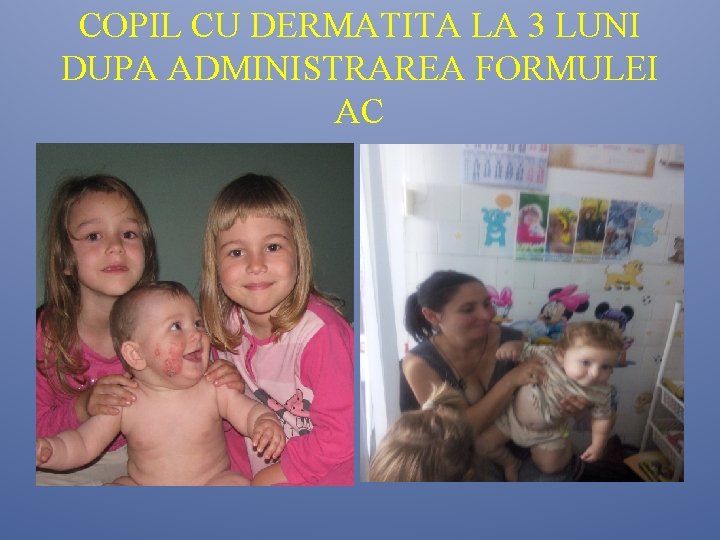 COPIL CU DERMATITA LA 3 LUNI DUPA ADMINISTRAREA FORMULEI AC COPIL CU DERMATITA LA 3 LUNI DUPA ADMINISTRAREA FORMULEI AC