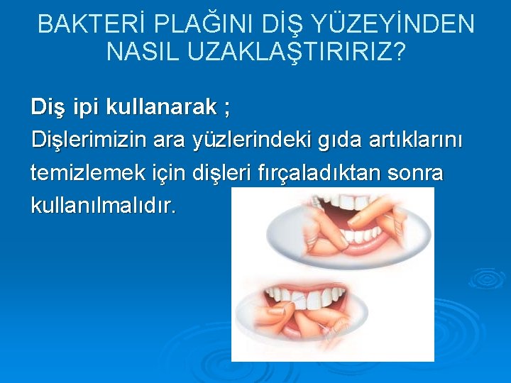 BAKTERİ PLAĞINI DİŞ YÜZEYİNDEN NASIL UZAKLAŞTIRIRIZ? Diş ipi kullanarak ; Dişlerimizin ara yüzlerindeki gıda