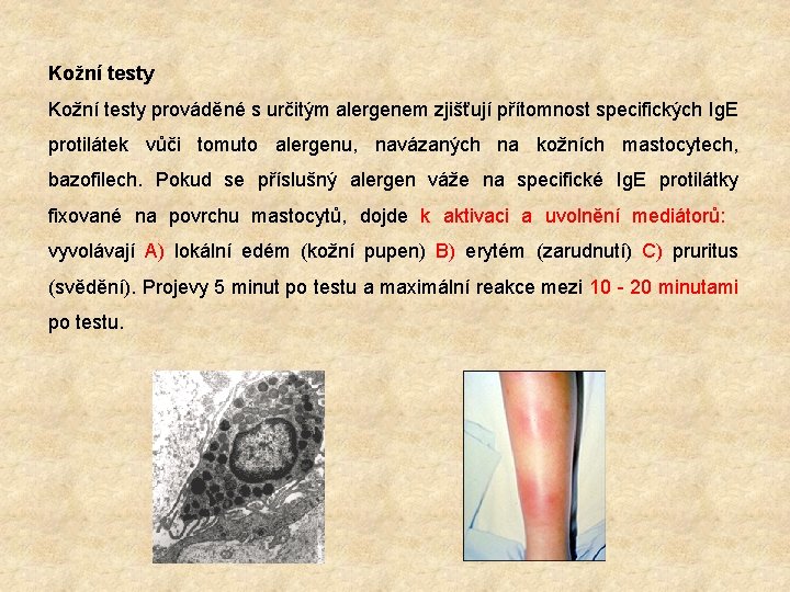 Kožní testy prováděné s určitým alergenem zjišťují přítomnost specifických Ig. E protilátek vůči tomuto