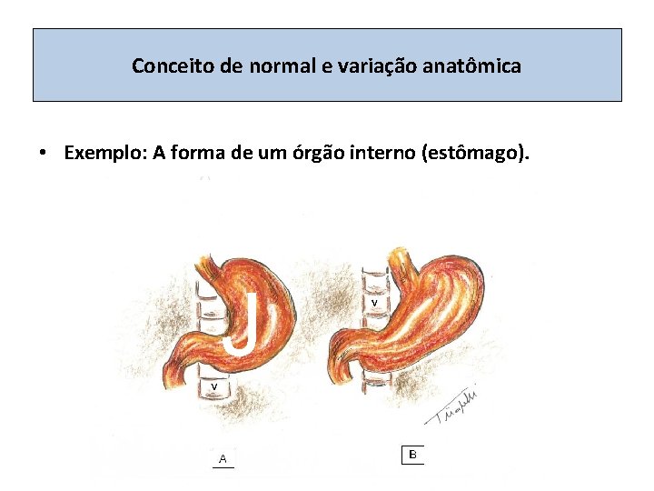 Conceito de normal e variação anatômica • Exemplo: A forma de um órgão interno