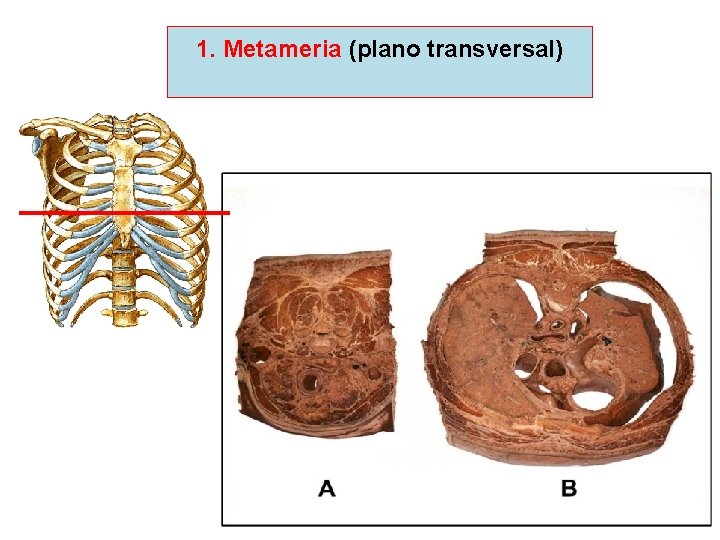 1. Metameria (plano transversal) 