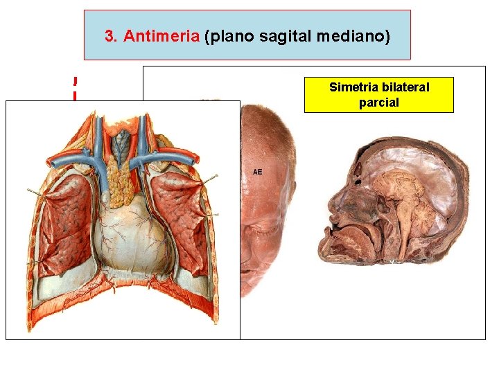 3. Antimeria (plano sagital mediano) Simetria bilateral parcial 
