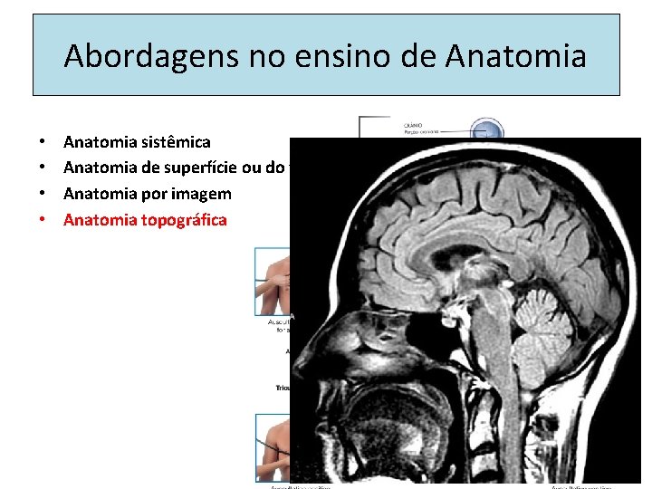 Abordagens no ensino de Anatomia • • Anatomia sistêmica Anatomia de superfície ou do