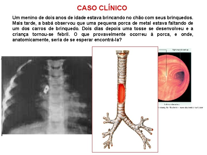 CASO CLÍNICO Um menino de dois anos de idade estava brincando no chão com