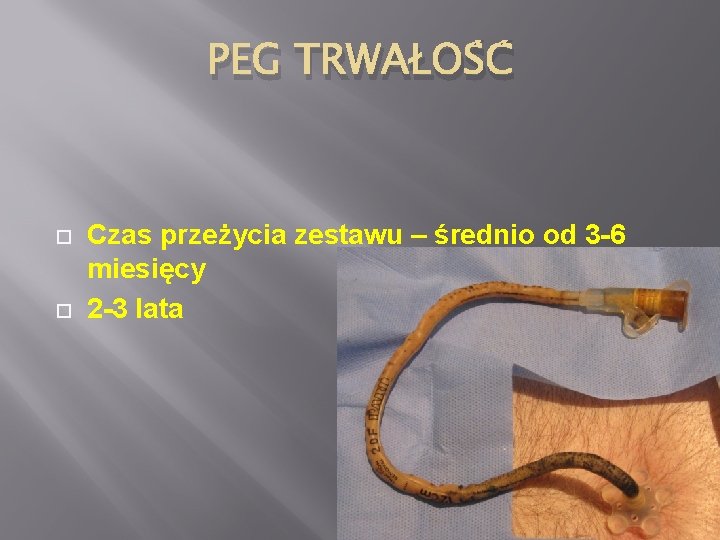 PEG TRWAŁOŚĆ Czas przeżycia zestawu – średnio od 3 -6 miesięcy 2 -3 lata