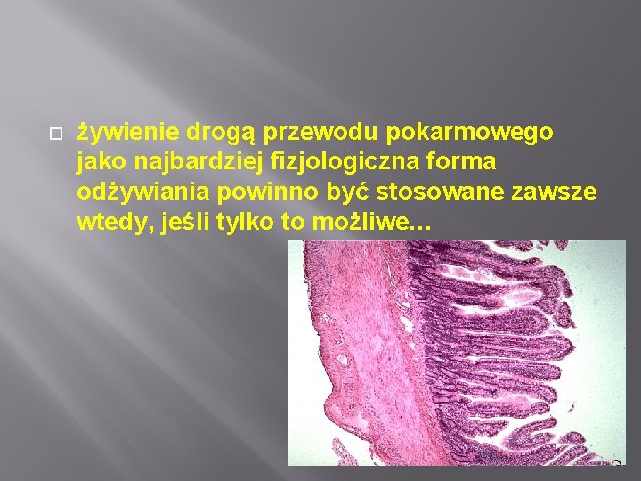  żywienie drogą przewodu pokarmowego jako najbardziej fizjologiczna forma odżywiania powinno być stosowane zawsze