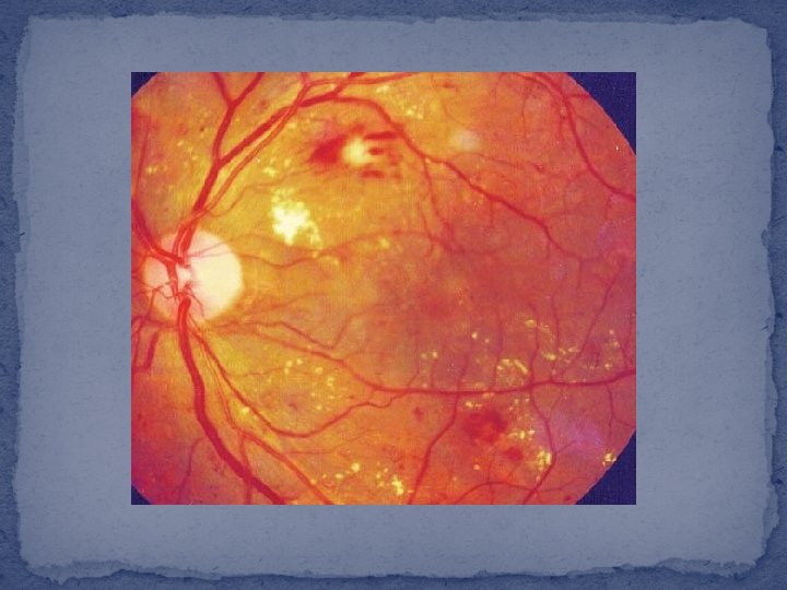 Metode de examinare a bolilor organului vizual