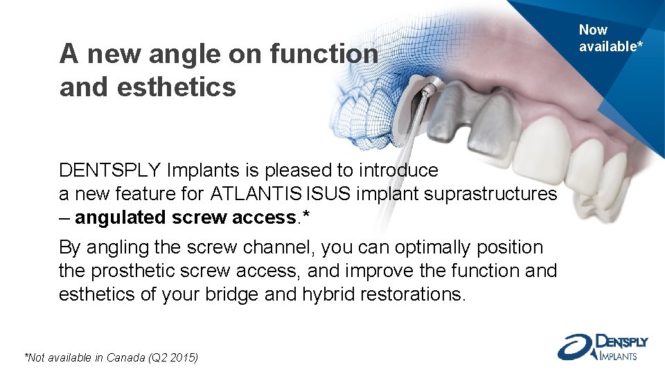 A new angle on function and esthetics DENTSPLY Implants is pleased to introduce a