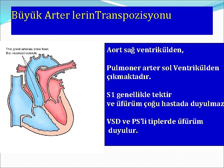Büyük Arter lerin. Transpozisyonu Aort sağ ventrikülden, Pulmoner arter sol Ventrikülden çıkmaktadır. S 1