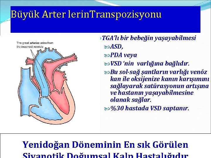Büyük Arter lerin. Transpozisyonu TGA’lı bir bebeğin yaşayabilmesi ASD, PDA veya VSD ‘nin varlığına