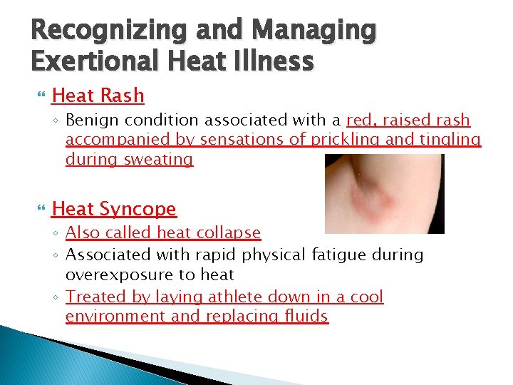 Recognizing and Managing Exertional Heat Illness Heat Rash ◦ Benign condition associated with a