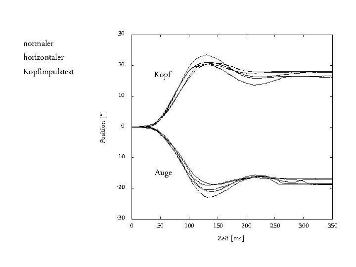 30 normaler horizontaler Kopfimpulstest 20 Kopf Position [°] 10 0 -10 Auge -20 -30
