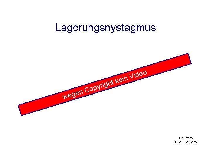 Lagerungsnystagmus deo i V n t kei h g i r y p n Lagerungsnystagmus deo i V n t kei h g i r y p n