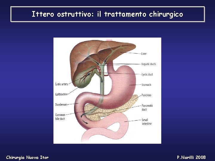 Ittero ostruttivo: il trattamento chirurgico Chirurgia Nuova Itor P. Narilli 2008 Ittero ostruttivo: il trattamento chirurgico Chirurgia Nuova Itor P. Narilli 2008