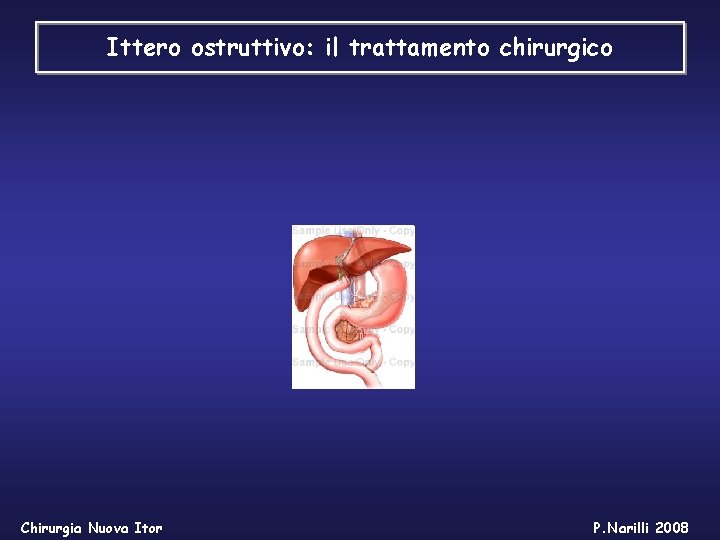 Ittero ostruttivo: il trattamento chirurgico Chirurgia Nuova Itor P. Narilli 2008 Ittero ostruttivo: il trattamento chirurgico Chirurgia Nuova Itor P. Narilli 2008