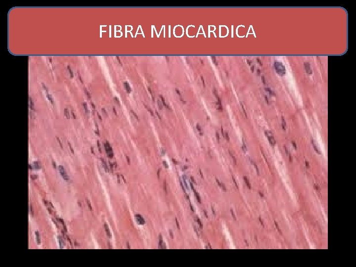 FIBRA MIOCARDICA 
