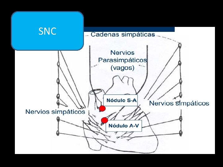 SNC 