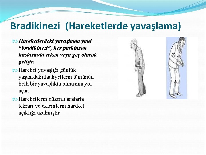 Bradikinezi (Hareketlerde yavaşlama) Hareketlerdeki yavaşlama yani “bradikinezi”, her parkinson hastasında erken veya geç olarak