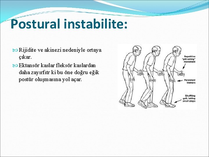 Postural instabilite: Rijidite ve akinezi nedeniyle ortaya çıkar. Ektansör kaslar fleksör kaslardan daha zayırfıtr