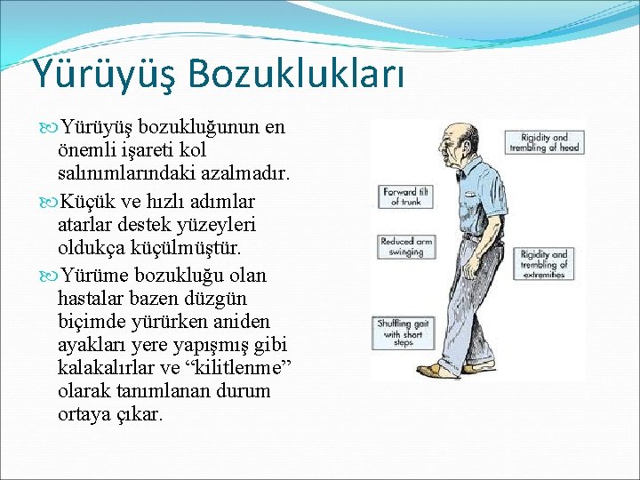 Yürüyüş Bozuklukları Yürüyüş bozukluğunun en önemli işareti kol salınımlarındaki azalmadır. Küçük ve hızlı adımlar