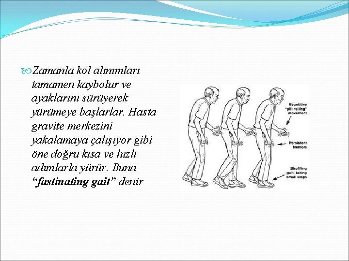  Zamanla kol alınımları tamamen kaybolur ve ayaklarını sürüyerek yürümeye başlarlar. Hasta gravite merkezini