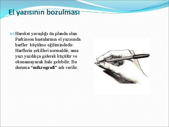 El yazısının bozulması Hareket yavaşlığı ön planda olan Parkinson hastalarının el yazısında harfler küçülme