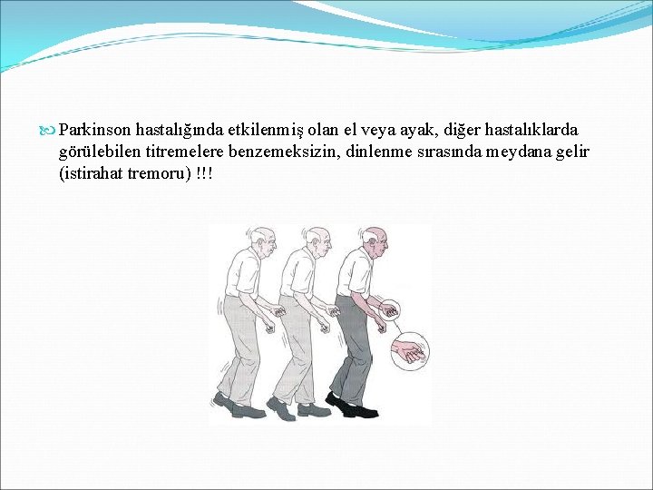  Parkinson hastalığında etkilenmiş olan el veya ayak, diğer hastalıklarda görülebilen titremelere benzemeksizin, dinlenme