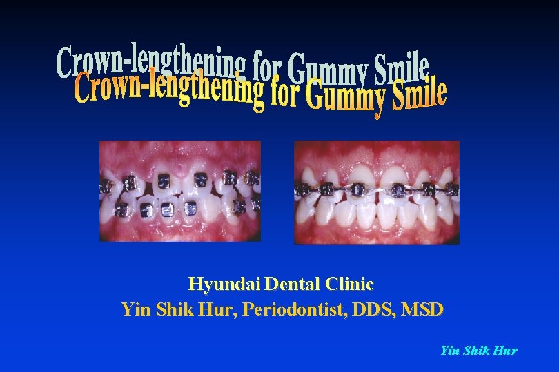 Hyundai Dental Clinic Yin Shik Hur, Periodontist, DDS, MSD Yin Shik Hur 