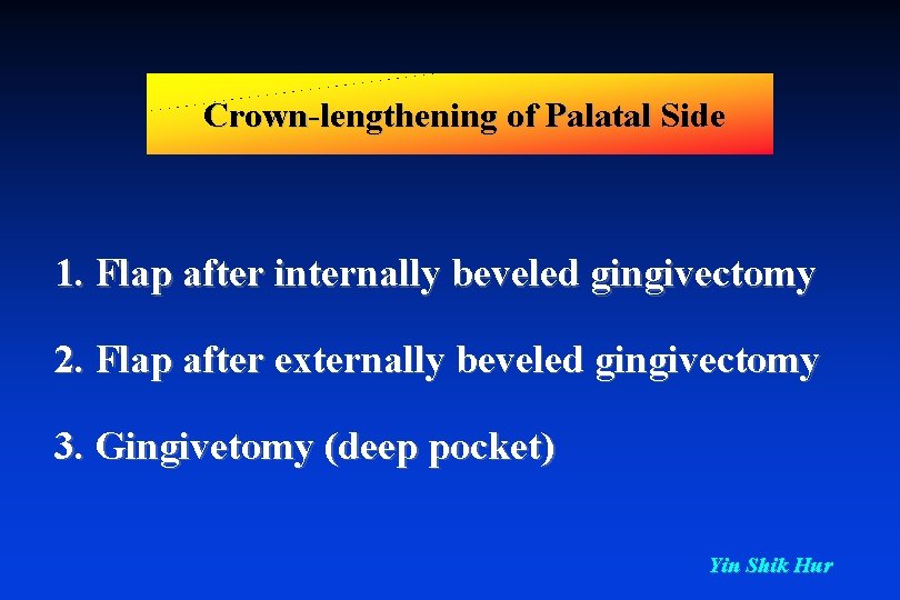 Crown-lengthening of Palatal Side 1. Flap after internally beveled gingivectomy 2. Flap after externally