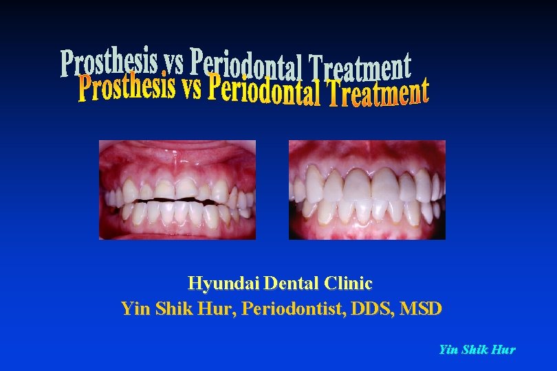 Hyundai Dental Clinic Yin Shik Hur, Periodontist, DDS, MSD Yin Shik Hur 