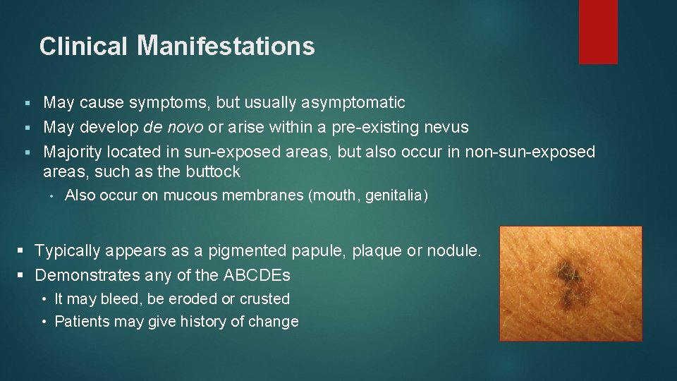 Clinical Manifestations May cause symptoms, but usually asymptomatic § May develop de novo or Clinical Manifestations May cause symptoms, but usually asymptomatic § May develop de novo or