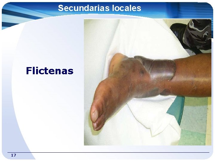 Secundarias locales Flictenas 17 