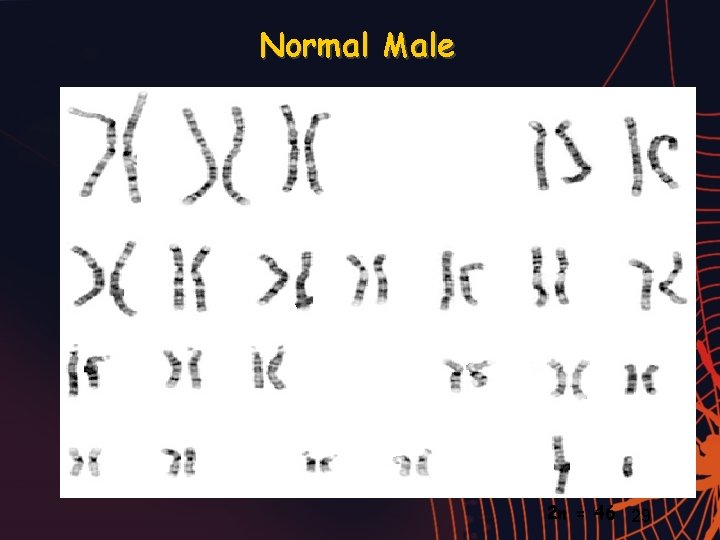 Normal Male 2 n = 46 29 